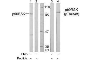 Image no. 3 for anti-Ribosomal Protein S6 Kinase, 90kDa, Polypeptide 1 (RPS6KA1) (pThr348) antibody (ABIN196796) (RPS6KA1 抗体  (pThr348))