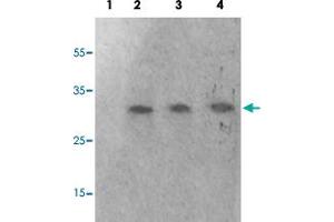 Western blot analysis of Lane 1: antigen-specific peptide treated 293 cells, Lane 2: 293 cells, Lane 3: HeLa cells, Lane 4: HepG2 cells with GAB2 (phospho S623) polyclonal antibody  at 1:500-1000 dilution. (GAB2 抗体  (pSer623))