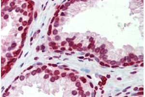 Human Prostate (formalin-fixed, paraffin-embedded) stained with BXDC5 antibody ABIN462228 followed by biotinylated goat anti-rabbit IgG secondary antibody ABIN481713, alkaline phosphatase-streptavidin and chromogen. (RPF1 抗体  (AA 45-94))