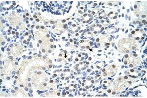 Immunohistochemistry (IHC) image for anti-Sjogren Syndrome Antigen B (SSB) (N-Term) antibody (ABIN2778846)