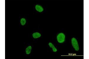 Immunofluorescence of purified MaxPab antibody to DIP2A on HeLa cell. (DIP2A 抗体  (AA 1-889))