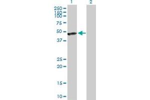 Western Blot analysis of CALR3 expression in transfected 293T cell line by CALR3 MaxPab polyclonal antibody. (Calreticulin 3 抗体  (AA 1-384))
