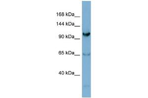 WB Suggested Anti-GEMIN4  Antibody Titration: 0. (GEMIN4 抗体  (N-Term))