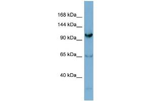 WB Suggested Anti-GEMIN4  Antibody Titration: 0.