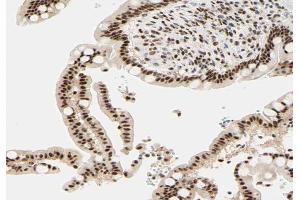 ABIN6266651 at 1/100 staining human colon tissue sections by IHC-P. (NCOR1 抗体  (N-Term))