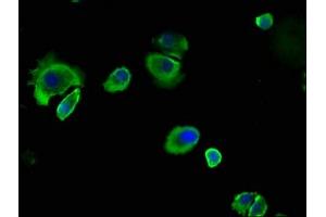 Immunofluorescence staining of MCF-7 cells with ABIN7146799 at 1:133, counter-stained with DAPI. (CEACAM5 抗体  (AA 1-255))