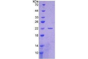 SDS-PAGE of Protein Standard from the Kit (Highly purified E. (CYFRA21.1 CLIA Kit)