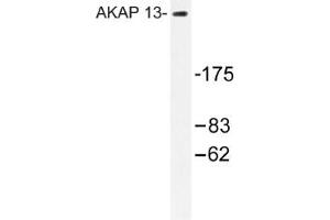 Image no. 1 for anti-A Kinase (PRKA) Anchor Protein 13 (AKAP13) antibody (ABIN317612) (AKAP13 抗体)