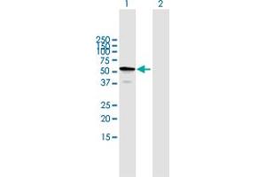 Western Blot analysis of TBC1D22B expression in transfected 293T cell line by TBC1D22B MaxPab polyclonal antibody. (TBC1D22B 抗体  (AA 1-505))