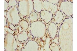 Immunohistochemistry of paraffin-embedded human thyroid tissue using ABIN7153105 at dilution of 1:100 (FOXR2 抗体  (AA 1-300))