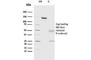 SDS-PAGE Analysis Purified Cathepsin D Mouse Monoclonal Antibody (CTSD/3082).