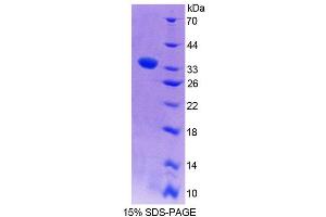 SDS-PAGE analysis of Rat PLCe1 Protein. (PLCE1 蛋白)