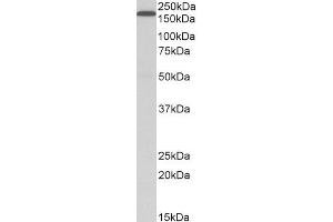 ABIN185410 (1µg/ml) staining of HepG2 lysate (35µg protein in RIPA buffer). (LRP5 抗体  (Internal Region))