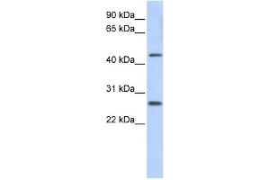 WB Suggested Anti-PRAMEF10 Antibody Titration: 0. (PRAMEF10 抗体  (Middle Region))