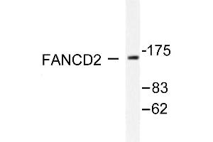 Image no. 3 for anti-Fanconi Anemia, Complementation Group D2 (FANCD2) antibody (ABIN265413) (FANCD2 抗体)