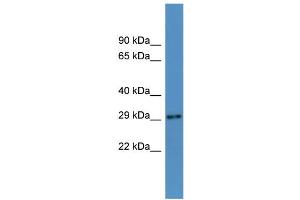 WB Suggested Anti-Auh Antibody Titration:  0. (AUH 抗体  (N-Term))