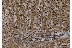 ABIN6273021 at 1/100 staining Human liver tissue by IHC-P. (TRIM44 抗体  (Internal Region))
