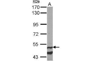 Western Blotting (WB) image for anti-Cannabinoid Receptor 1 (CNR1) (C-Term) antibody (ABIN2854658)