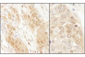 Immunohistochemistry (IHC) image for anti-Parkinson Protein 7 (PARK7) (C-Term) antibody (ABIN7454672) (PARK7/DJ1 抗体  (C-Term))
