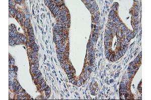 Image no. 3 for anti-Prostaglandin E Synthase 2 (PTGES2) antibody (ABIN1500491)