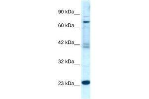 WB Suggested Anti-RGS10  Antibody Titration: 0. (RGS10 抗体  (Middle Region))