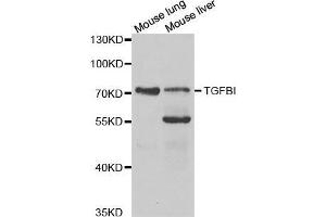 Western blot analysis of extracts of various cell lines, using TGFBI antibody. (TGFBI 抗体  (AA 481-683))