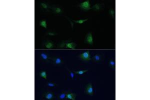 Immunofluorescence analysis of C6 cells using VCP antibody (ABIN6128632, ABIN6150072, ABIN6150073 and ABIN6217335) at dilution of 1:100. (VCP 抗体  (AA 647-806))