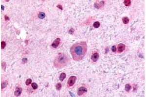 Mouse, Brain (formalin-fixed, paraffin-embedded) stained with GLI2 antibody ABIN214612 at 5 ug/ml followed by biotinylated goat anti-rabbit IgG secondary antibody ABIN481713, alkaline phosphatase-streptavidin and chromogen. (GLI2 抗体  (Internal Region))