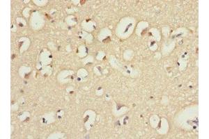 Immunohistochemistry of paraffin-embedded human brain tissue using ABIN7156852 at dilution of 1:100 (IL21 Receptor 抗体  (AA 20-240))