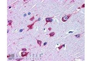 Immunohistochemistry (IHC) image for anti-Amyotrophic Lateral Sclerosis 2 (Juvenile) (ALS2) (C-Term) antibody (ABIN2465394) (ALS2 抗体  (C-Term))