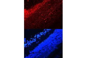 Immunofluorescence (IF) image for anti-Interleukin 17A (IL17A) (AA 24-155) antibody (ABIN3021083) (Interleukin 17a 抗体  (AA 24-155))