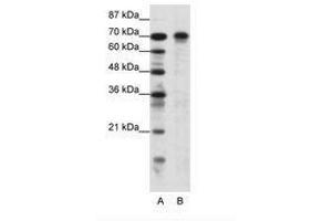 Image no. 1 for anti-Hypermethylated in Cancer 1 (HIC1) (AA 209-258) antibody (ABIN6736116) (HIC1 抗体  (AA 209-258))