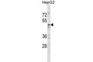 Western Blotting (WB) image for anti-TAP Binding Protein-Like (TAPBPL) antibody (ABIN2998744) (TAPBPL 抗体)