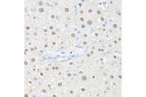 Immunohistochemistry of paraffin-embedded rat liver using MLF2 antibody (ABIN7268725) at dilution of 1:100 (40x lens). (MLF2 抗体  (AA 1-65))