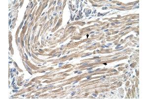 MGST2 antibody was used for immunohistochemistry at a concentration of 4-8 ug/ml to stain Skeletal muscle cells (arrows) in Human Muscle. (MGST2 抗体  (N-Term))