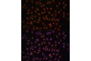 Immunofluorescence analysis of C6 cells using FCF1 antibody (ABIN7267162) at dilution of 1:100. (FCF1 抗体)