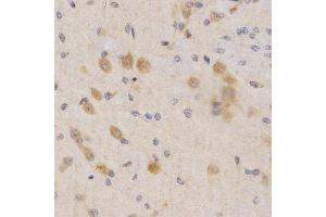 Immunohistochemistry (IHC) image for anti-3-phosphoinositide Dependent Protein Kinase-1 (PDPK1) (AA 150-429) antibody (ABIN3022352) (PDPK1 抗体  (AA 150-429))