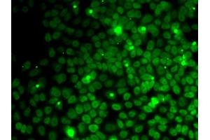 Immunofluorescence analysis of MCF7 cells using UFD1L antibody (ABIN1683208, ABIN5664259, ABIN5664261 and ABIN6220174). (UFD1L 抗体  (AA 1-307))