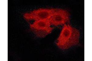 ABIN6267505 staining Hela cells by ICC/IF. (CASR 抗体  (pThr888))