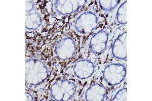 Immunohistochemistry of paraffin-embedded human colon using L-Plastin/LCP1 Rabbit mAb (ABIN7268317) at dilution of 1:100 (40x lens). (LCP1 抗体)