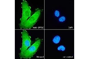 (ABIN570939) Immunofluorescence analysis of paraformaldehyde fixed U251 cells, permeabilized with 0. (CPT1C 抗体  (Internal Region))