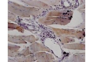 Expression of RyR1 in rat skeletal muscle - Immunohistochemical staining of paraffin embedded sections of rat quadriceps using Anti-Ryanodine Receptor 1 Antibody (ABIN7043604, ABIN7045211 and ABIN7045212), (1:100). (RYR1 抗体  (Intracellular, N-Term))