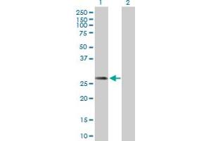 Western Blot analysis of DCI expression in transfected 293T cell line by DCI MaxPab polyclonal antibody. (DCI 抗体  (AA 1-243))