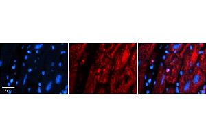 Rabbit Anti-MRPS15 Antibody    Formalin Fixed Paraffin Embedded Tissue: Human Adult heart  Observed Staining: Nuclear, Cytoplasmic Primary Antibody Concentration: 1:600 Secondary Antibody: Donkey anti-Rabbit-Cy2/3 Secondary Antibody Concentration: 1:200 Magnification: 20X Exposure Time: 0. (MRPS15 抗体  (N-Term))