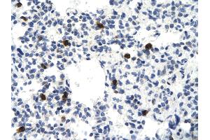 Immunohistochemistry (IHC) image for anti-Vascular Endothelial Zinc Finger 1 (VEZF1) (Middle Region) antibody (ABIN2776482)