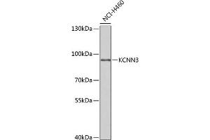 Western blot analysis of extracts of NCI-H460 cells, using KCNN3 antibody (ABIN6131840, ABIN6142769, ABIN6142771 and ABIN6221723) at 1:1000 dilution. (KCNN3 抗体  (AA 237-426))