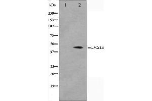 Western blot analysis on Jurkat cell lysate using LMX1B Antibody,The lane on the left is treated with the antigen-specific peptide. (LMX1B 抗体  (Internal Region))