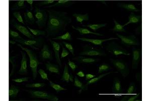 Immunofluorescence of monoclonal antibody to RPS6KA6 on HeLa cell. (RPS6KA6 抗体  (AA 636-745))