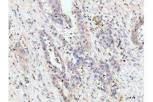 IHC analysis of Golgin 97/GOLGA1 using anti-Golgin 97/GOLGA1 antibody (ABIN7599539).