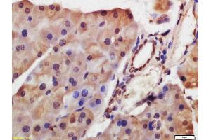 Formalin-fixed and paraffin embedded mouse pancreas labeled with Anti-HDAC8 Polyclonal Antibody, Unconjugated  at 1:200 followed by conjugation to the secondary antibody and DAB staining. (HDAC8 抗体  (AA 151-250))
